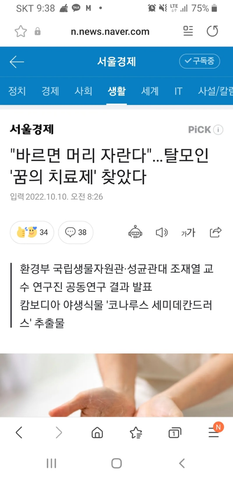 탈모 치료제??.news