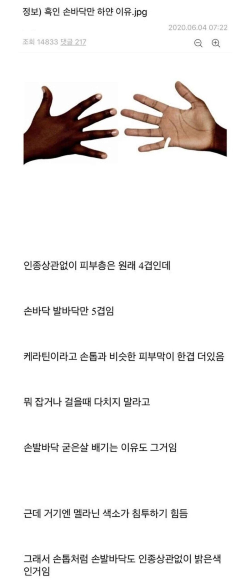 흑인의 손바닥이 하얀이유