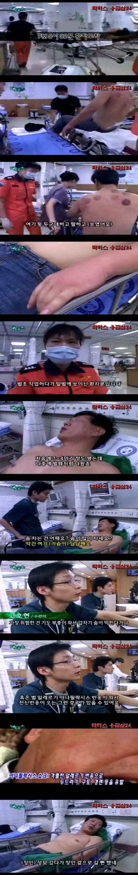 고전_벌에 쏘여 응급실에 온 환자의 드립