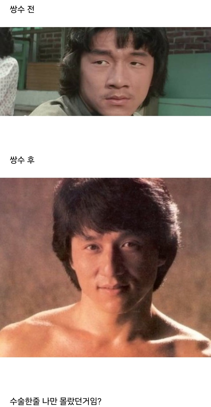 쌍수로 대박난 중국 배우 