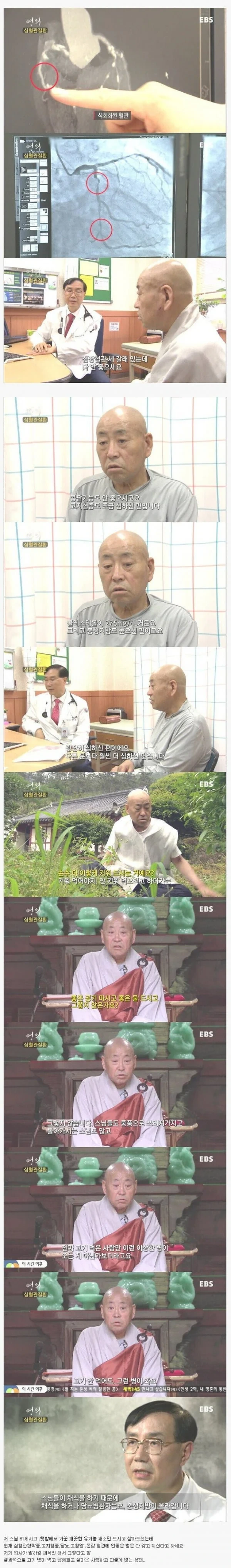 채식만 했는데도 심혈관질환이 온 스님