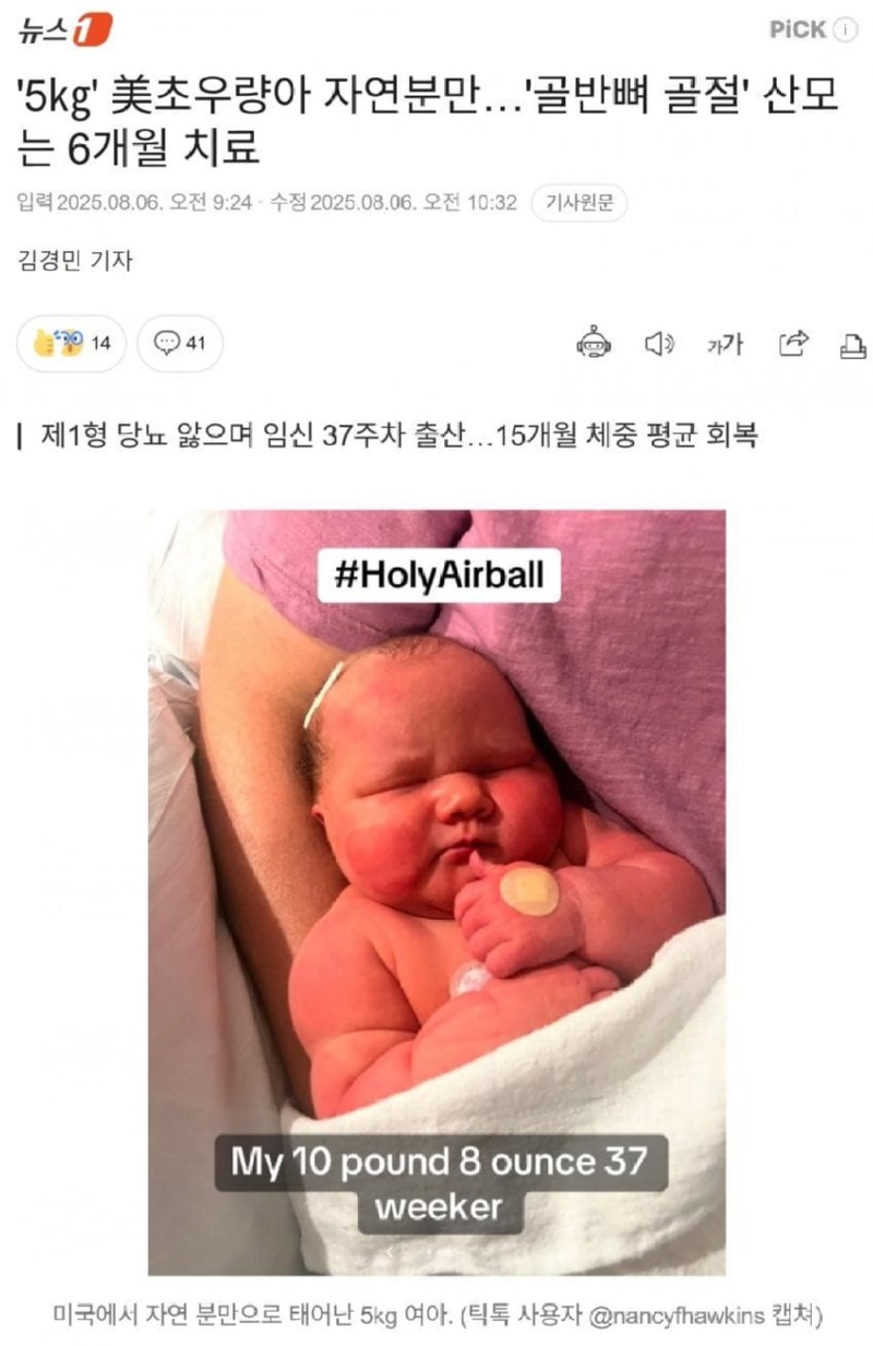 5㎏ 초우량아 자연분만…산모는 골반뼈골절